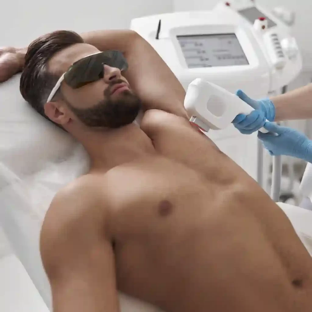 Laser Hair Removal For Men