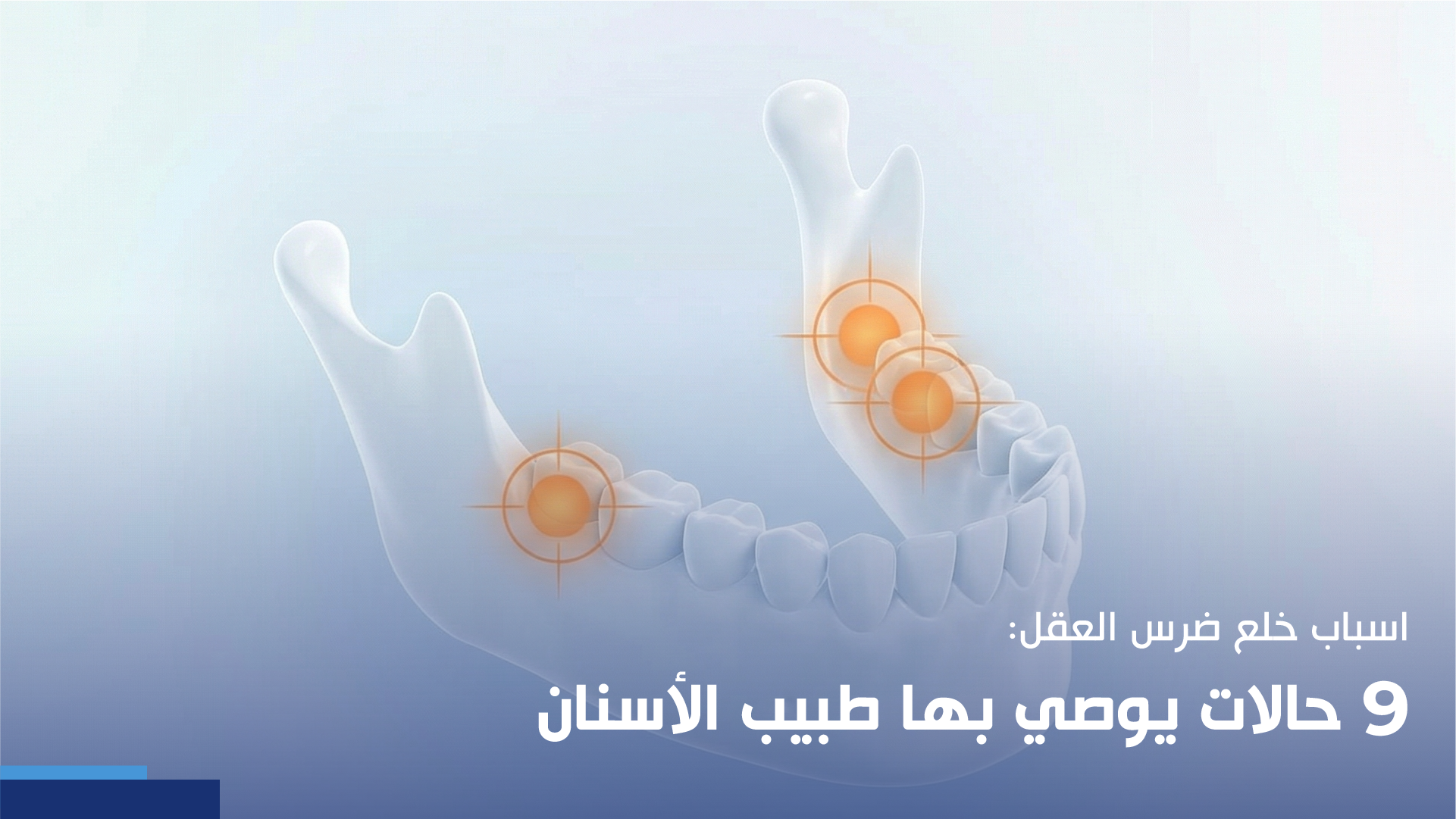 اسباب خلع ضرس العقل