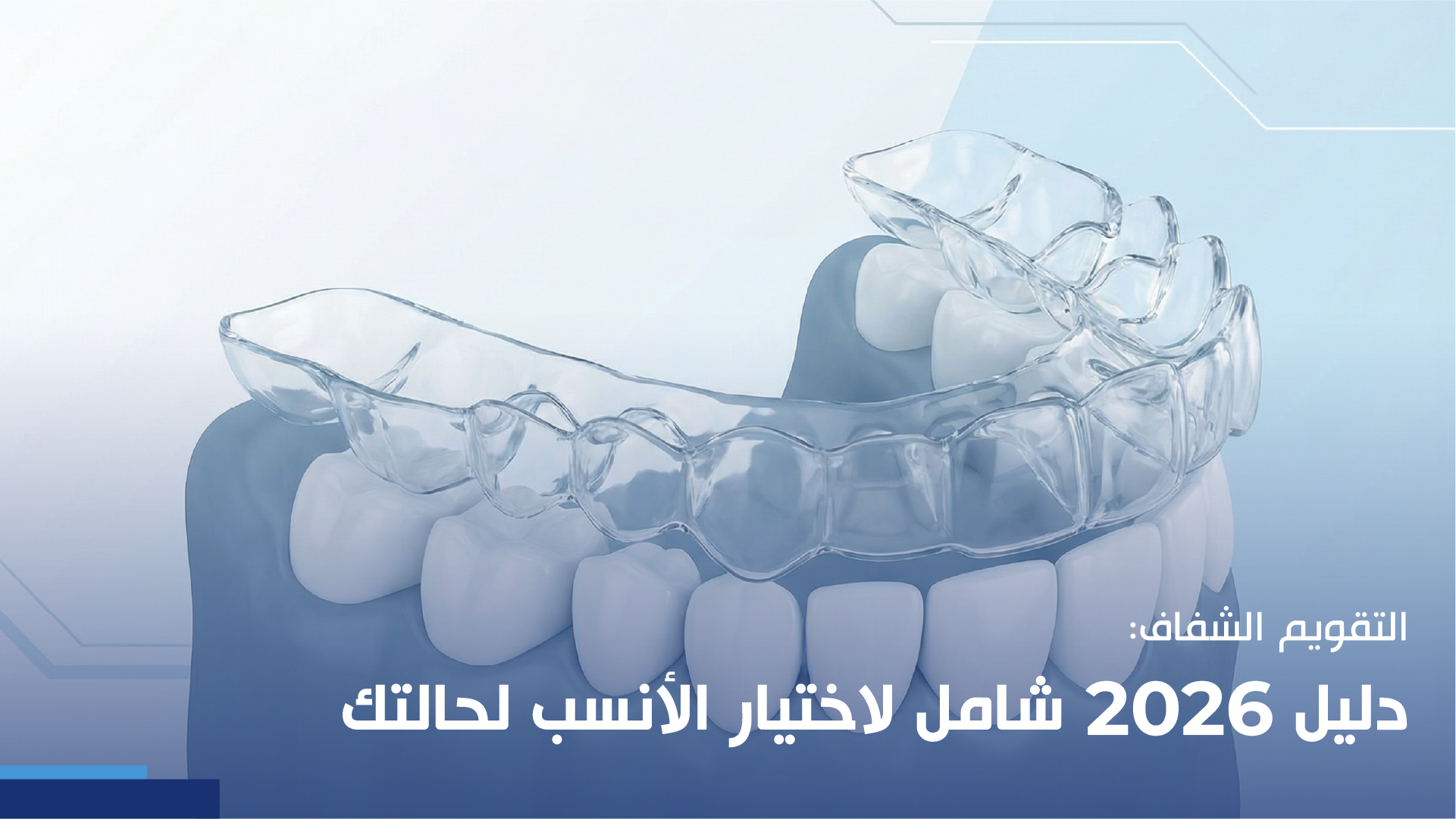 التقويم الشفاف