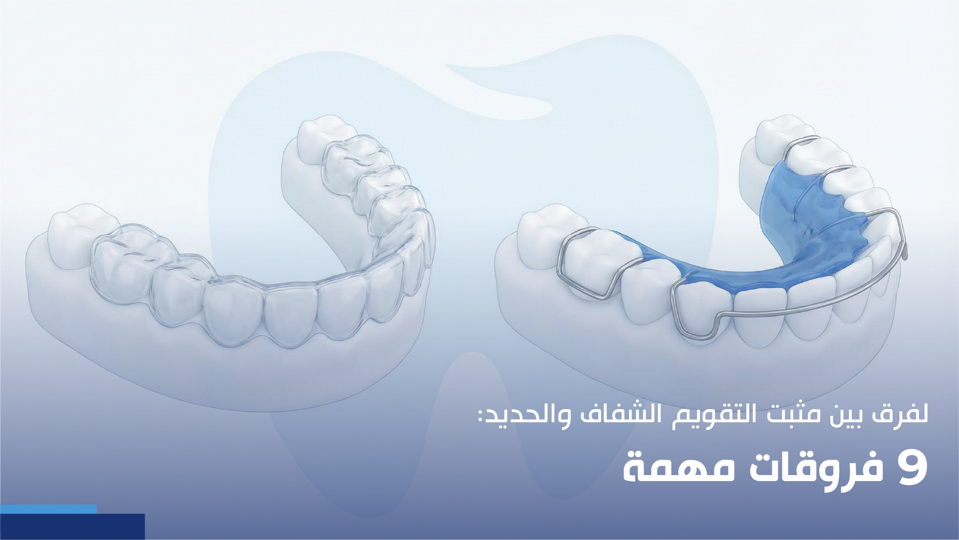 الفرق بين مثبت التقويم الشفاف والحديد: 9 فروقات مهمة