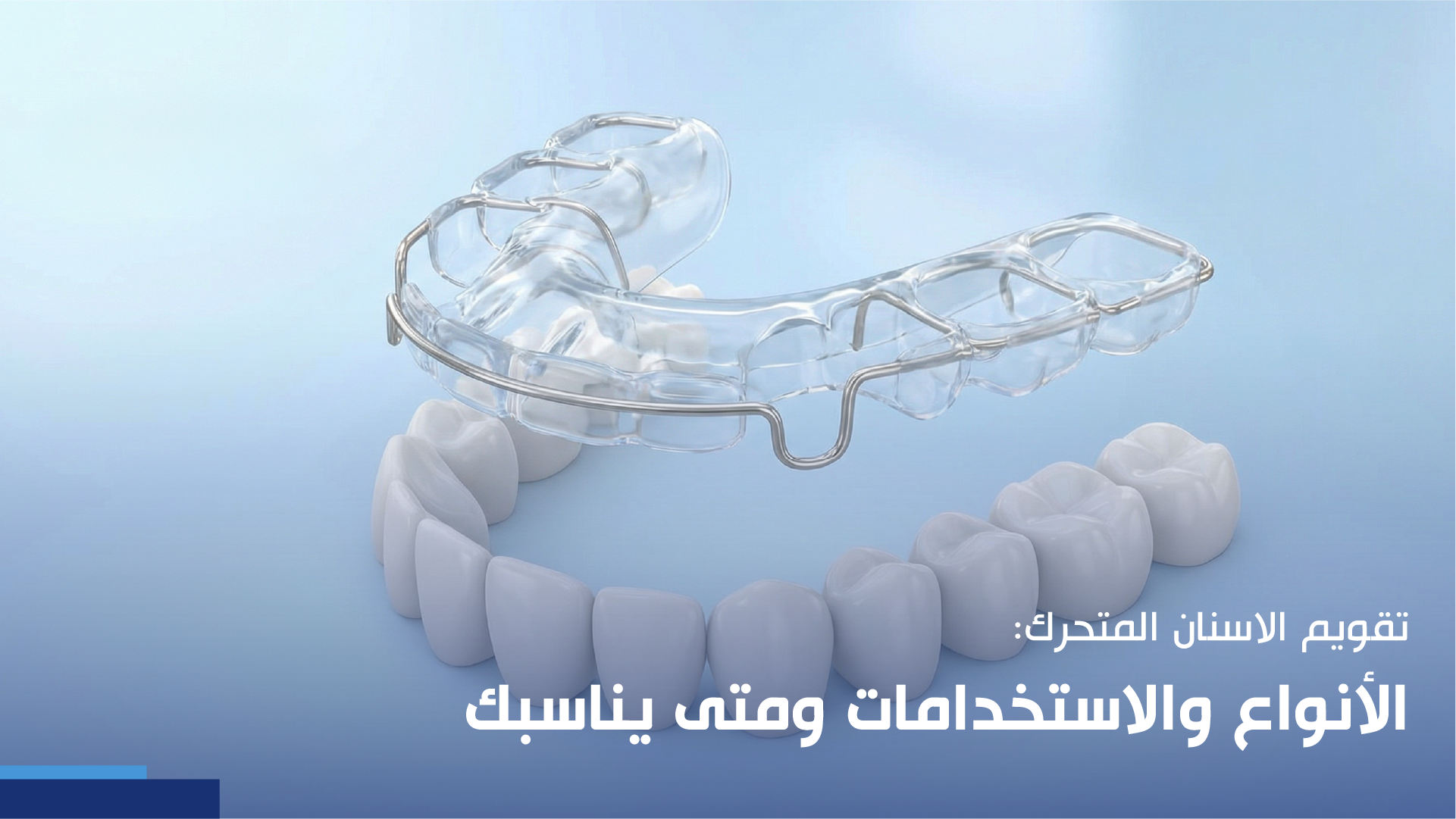 تقويم الاسنان المتحرك