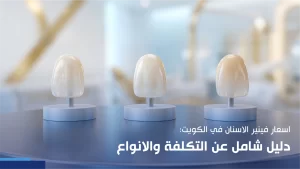 اسعار فينير الاسنان
