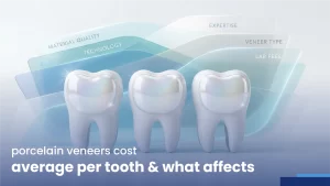 porcelain veneers cost