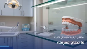 مشاكل تركيبات الاسنان الثابتة