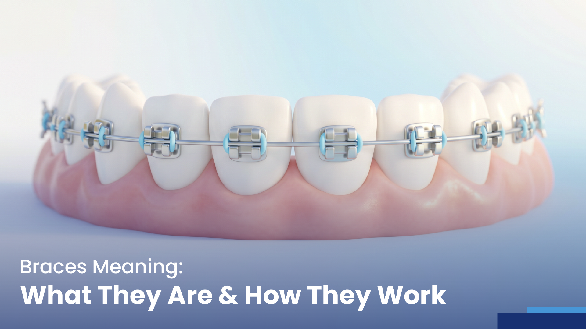 braces meaning