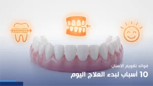 فوائد تقويم الاسنان