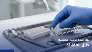 سعر قشرة الاسنان التجميلية