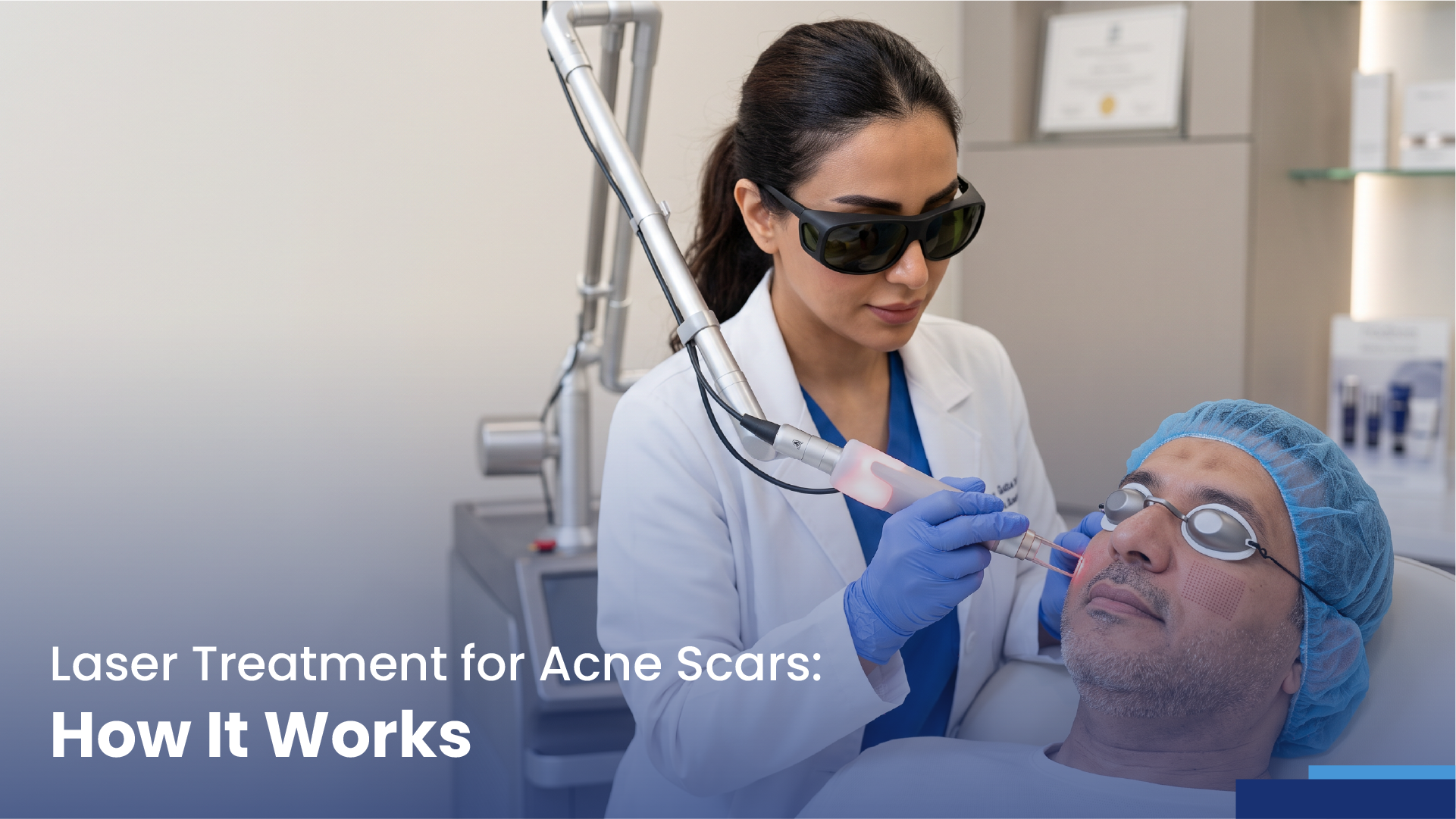 laser treatment for acne scars