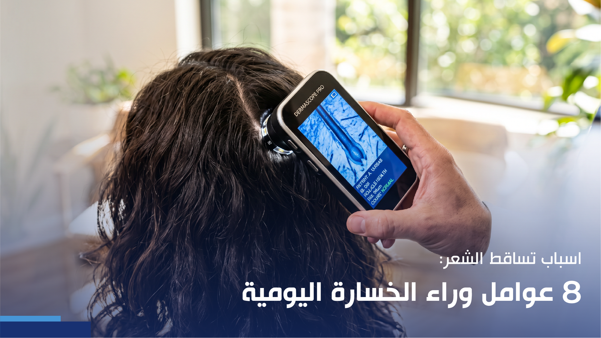 اسباب تساقط الشعر