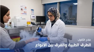 علاج الثالول