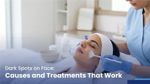 dark spots on face