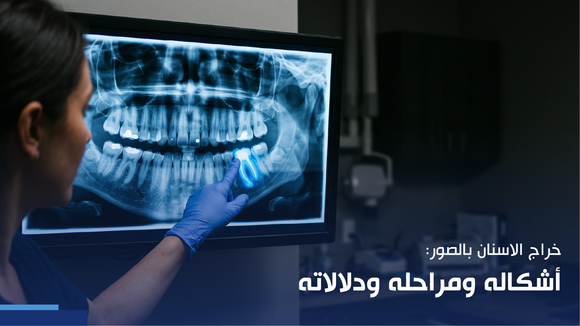 خراج الاسنان بالصور