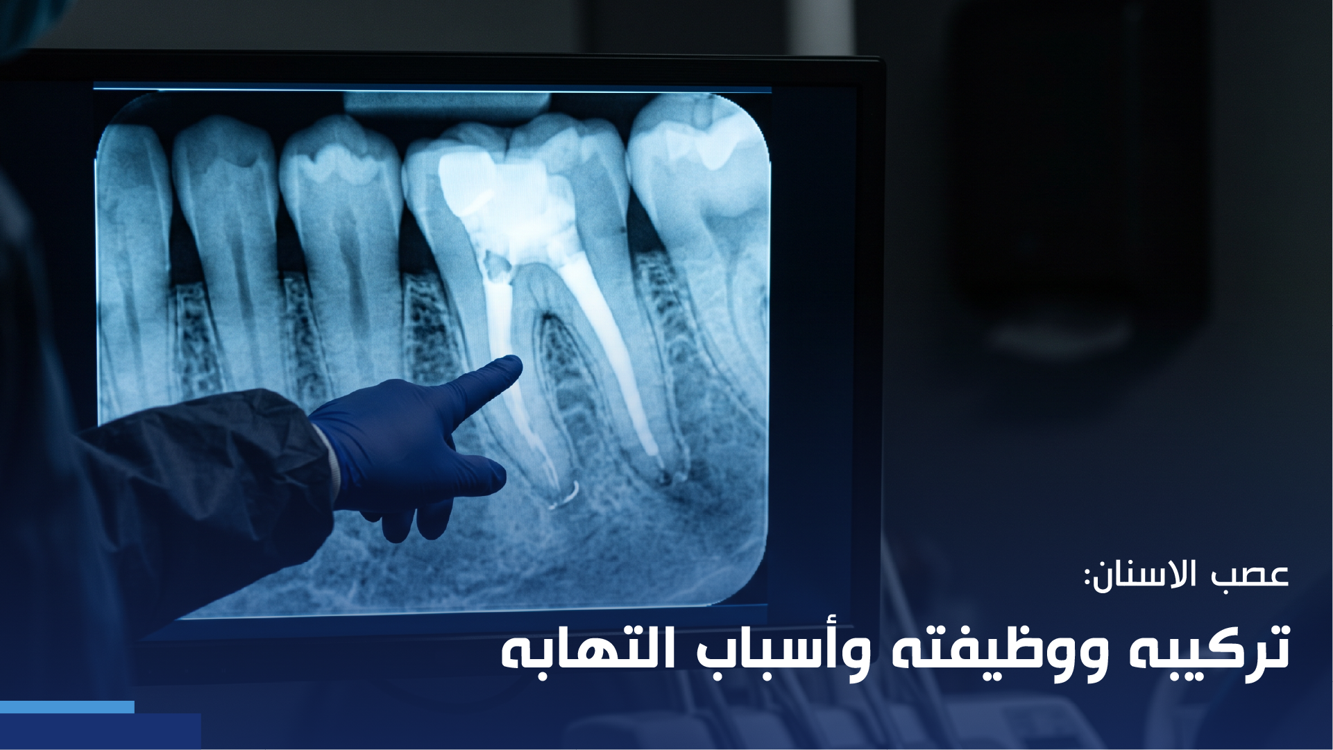 عصب الاسنان